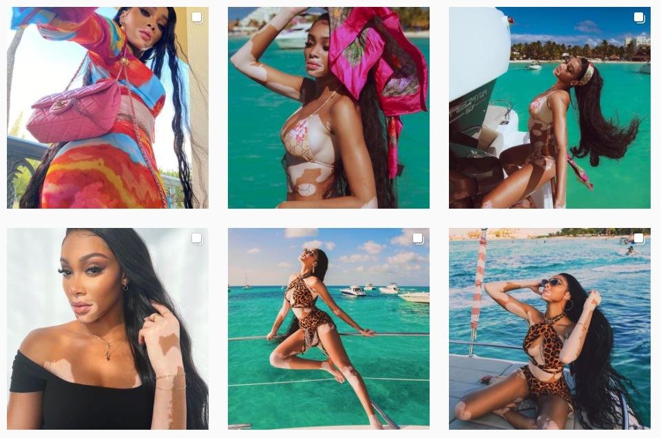 Instagram Winnie Harlow